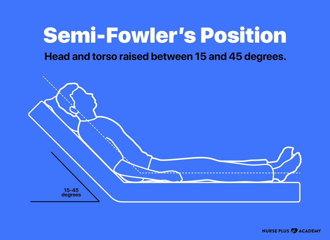 Semi-Fowler's position | Nurse Plus